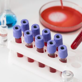 coronavirus-vaccine-lab-with-samples coronavirus-vaccine-lab-with-samples